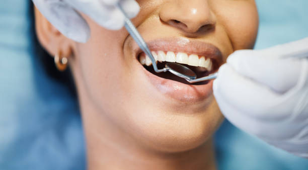 Best Broken or Cracked Tooth Emergency Dentist in Union City, GA